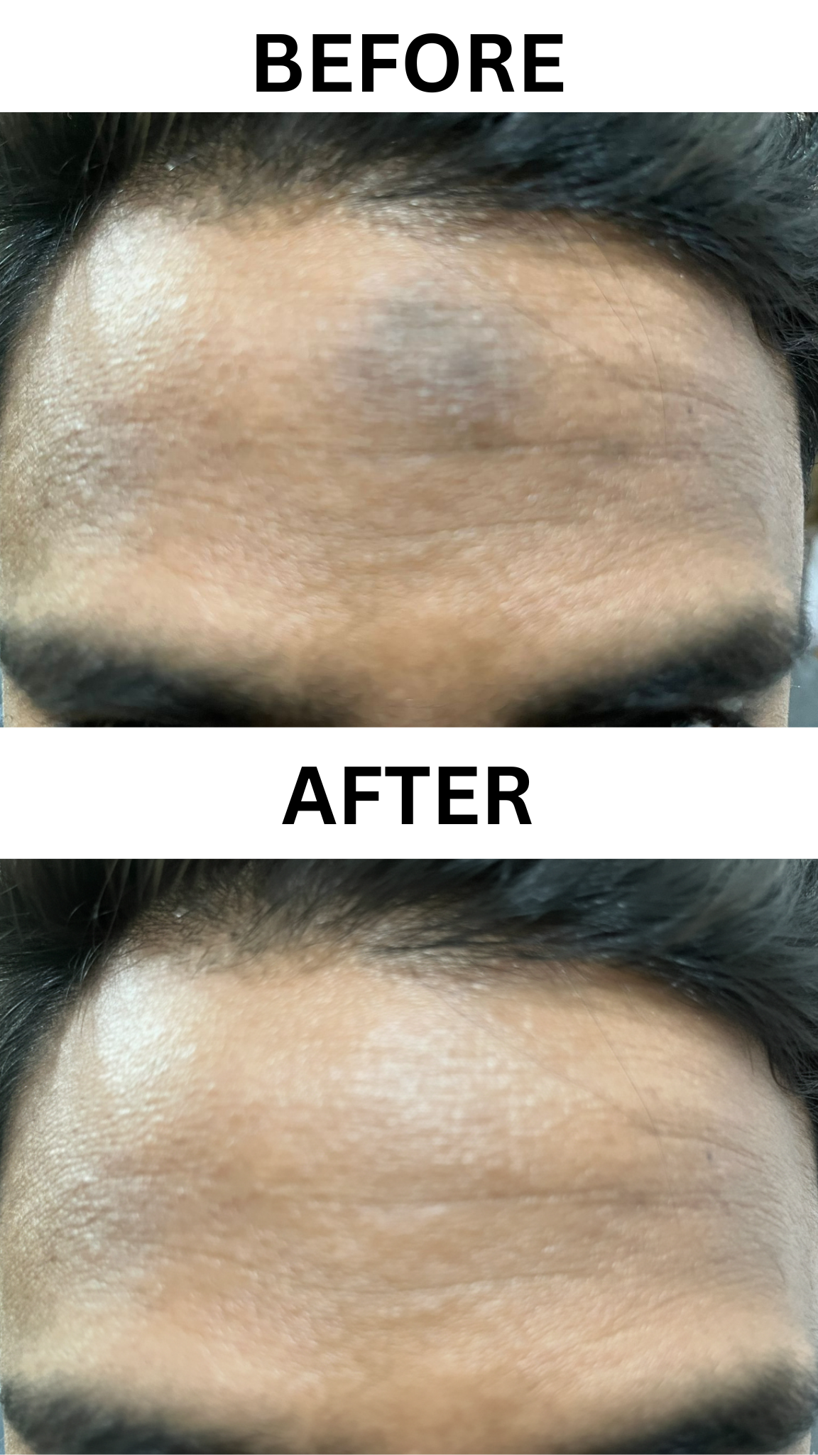 Rano Beauty Cream